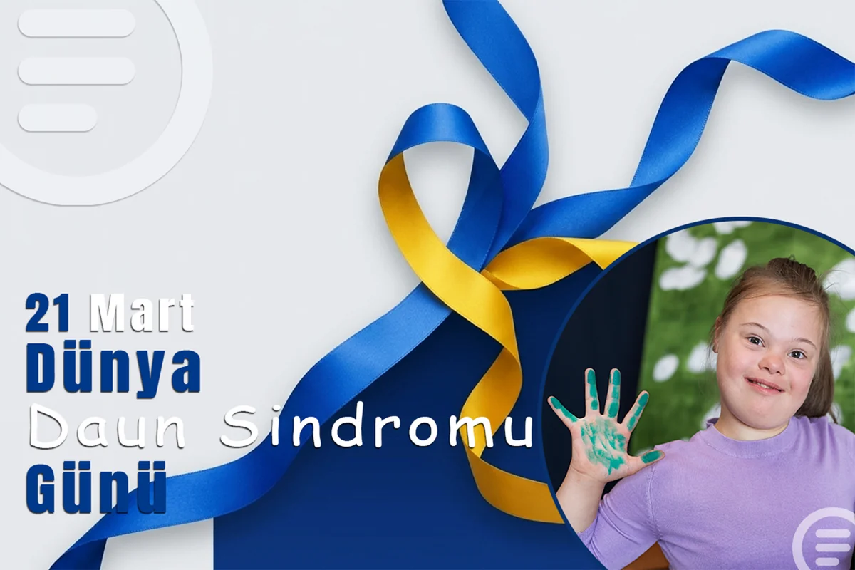 Beynəlxalq Daun Sindromu Günüdür