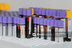 7UZqfnAuF3gHu5qxbyCOCMzpWXlbhTAXxiGpaZ1c_1200